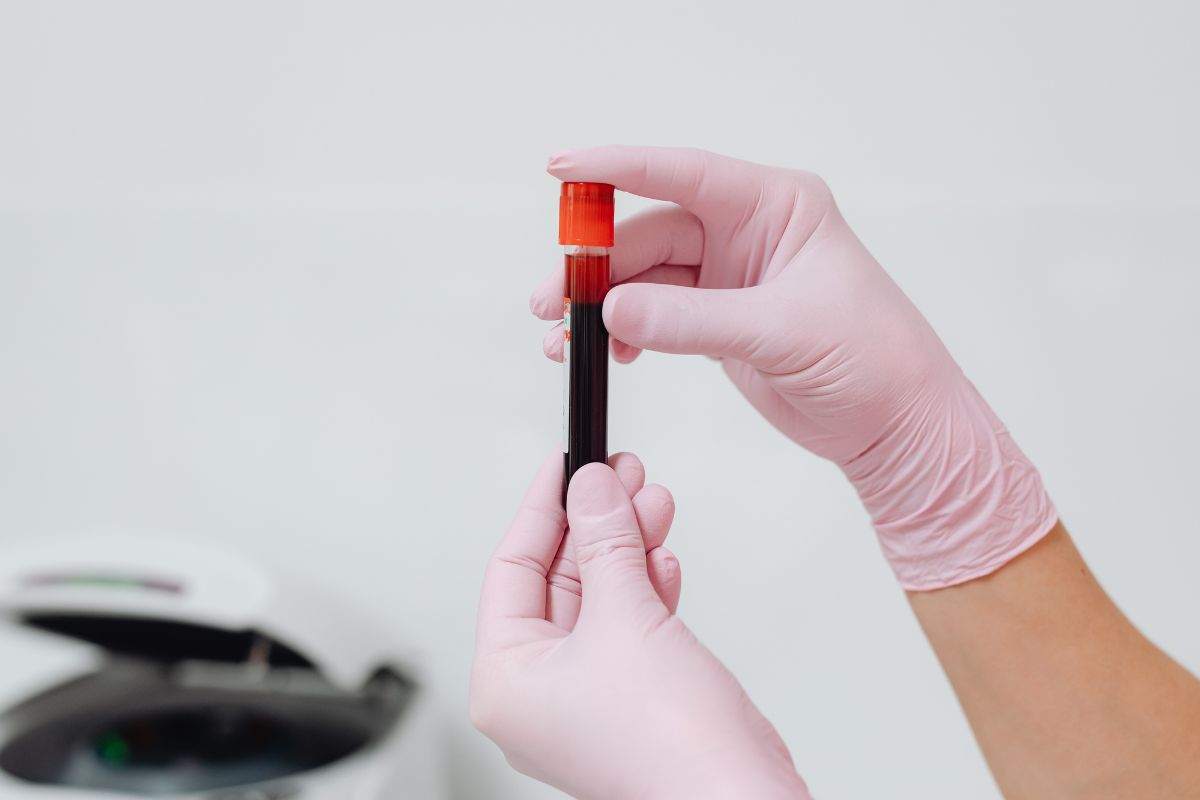 Hematologista alerta que anemia não tratada pode sobrecarregar o coração